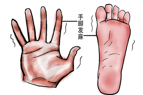 手腳經(jīng)常發(fā)麻是什么原因?手腳發(fā)麻可能患有哪些疾??？